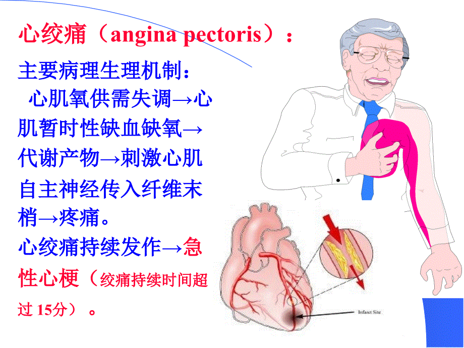 抗心绞痛药目的要求_第2页