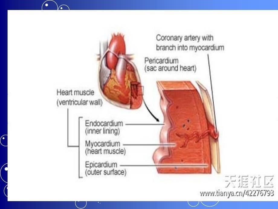 心肌梗死英文ppt课件_第5页
