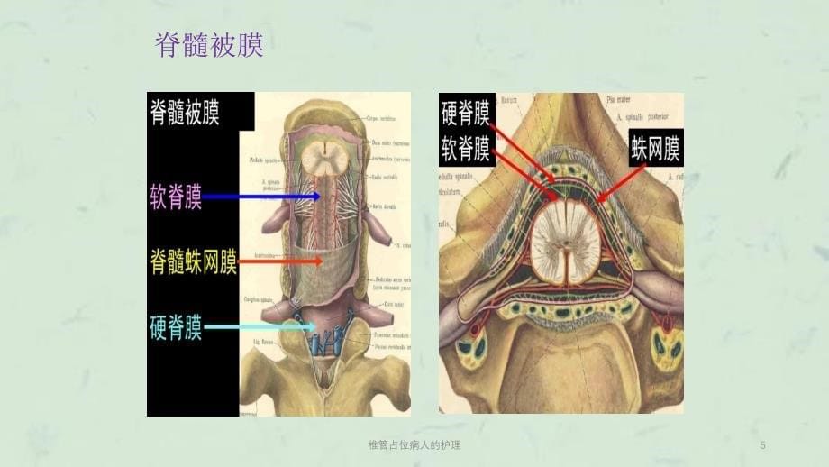 椎管占位病人的护理课件_第5页