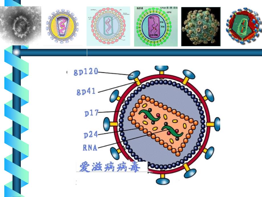 传染病学课件：Acquired Immune Deficiency syndrome_第4页