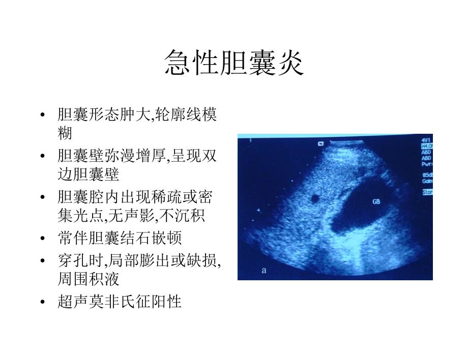 超声影像学：急性胆囊炎_第1页