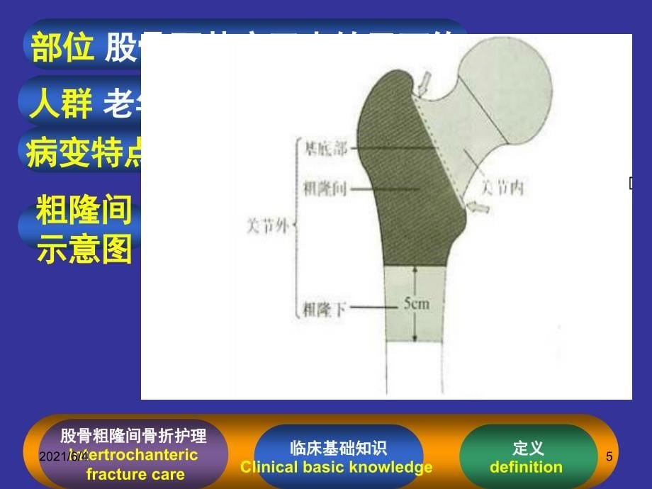 股骨粗隆间骨折护理个案_第5页