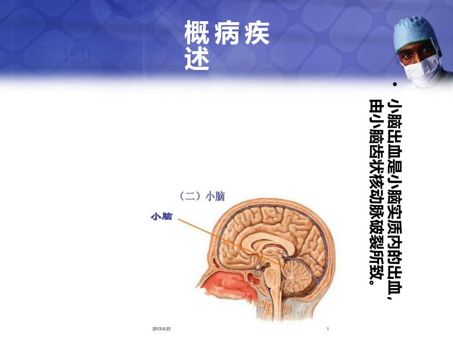 优质课件小脑出血护理查房_第3页