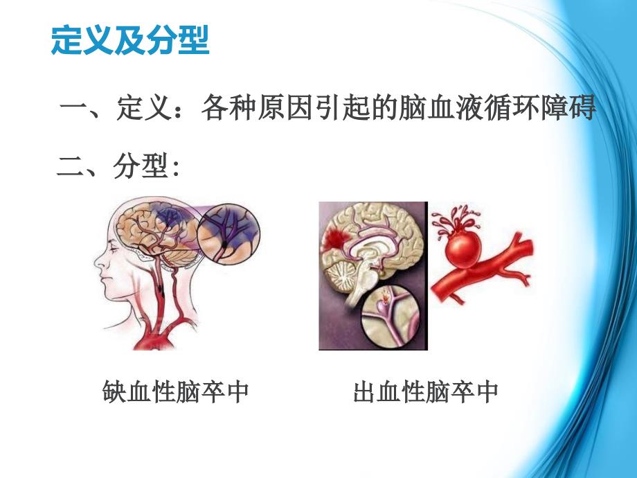 脑卒中家庭急救_第4页