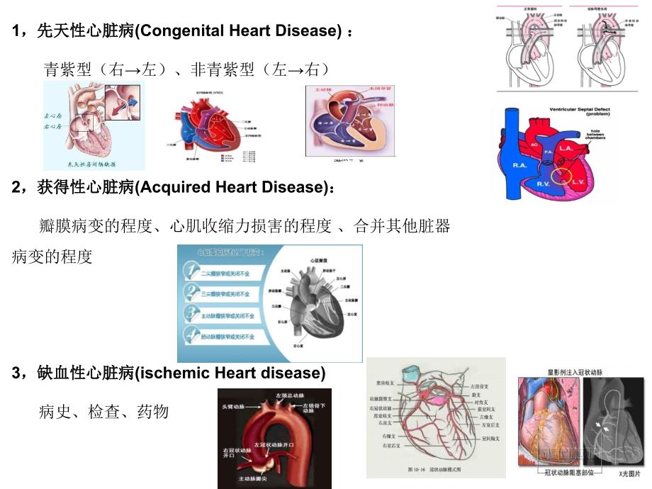 心脏病人的麻醉_第2页