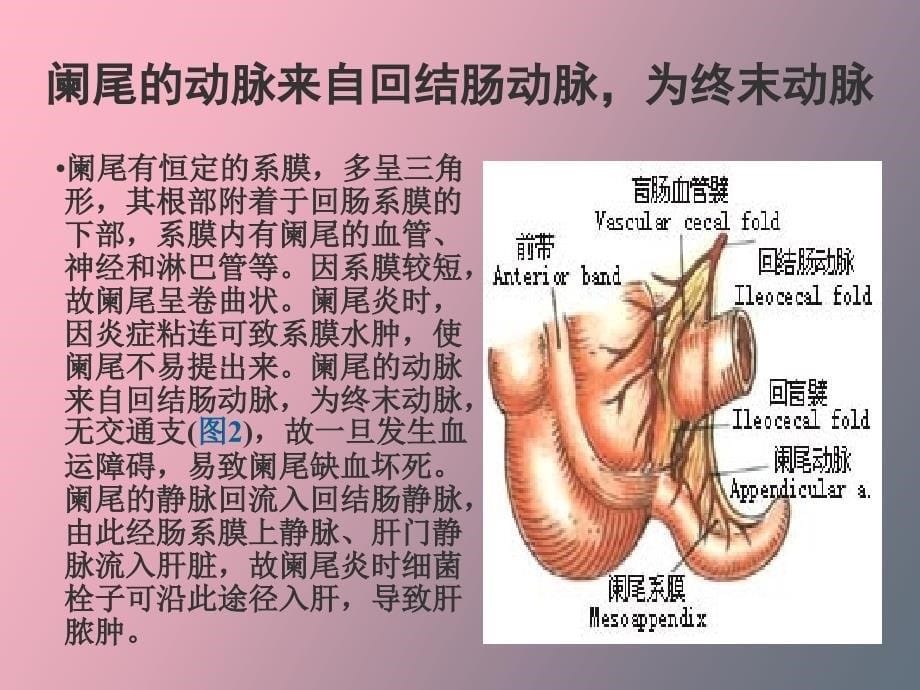 阑尾切除术图解_第5页