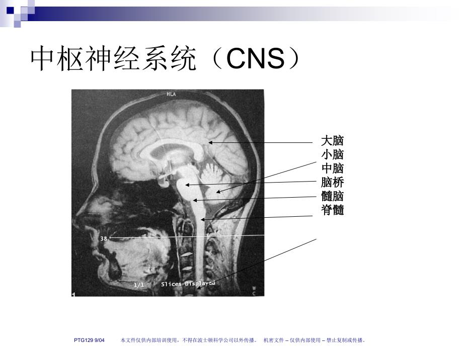 人脑和脑血管解剖分析 (NXPowerite)_第3页