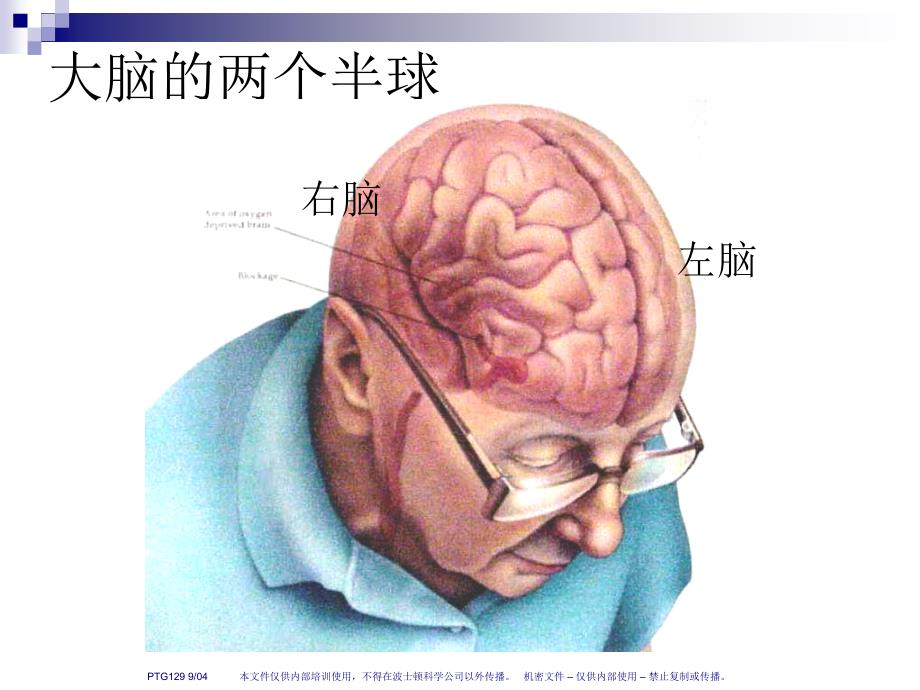 人脑和脑血管解剖分析 (NXPowerite)_第4页