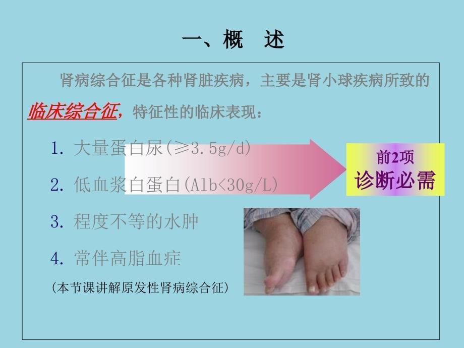 内科学——肾病综合征ppt课件_第5页