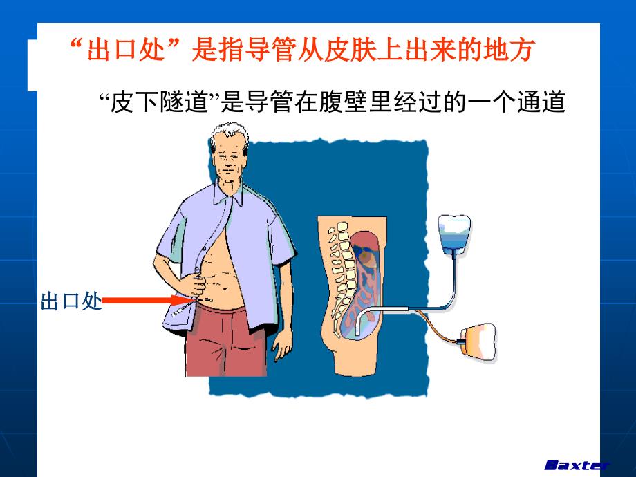 腹膜透析自我管理_第3页