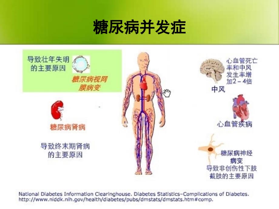 糖尿病并发症的预防与治疗课件_第2页