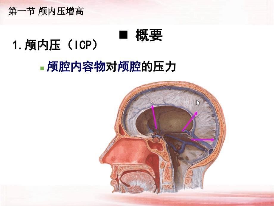 颅脑疾病病人的护理 2课件_第5页