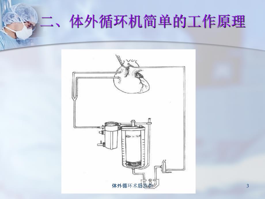 体外循环术后监护课件_第3页