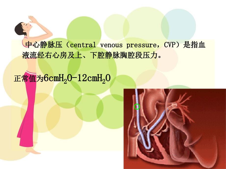 中心静脉压CVP监测_第2页