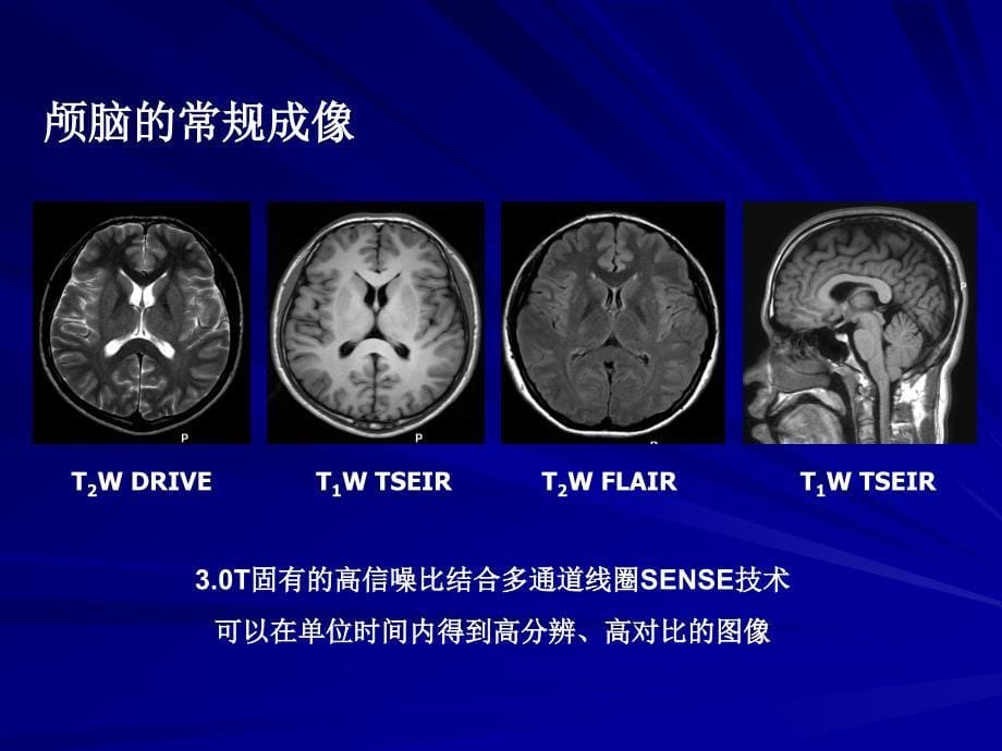 tmr在神经系统及骨关节系统中的初步临床应用 ppt课件_第5页