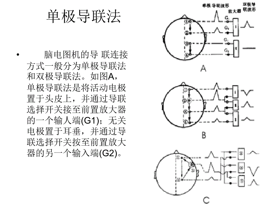 脑电图机的导联方式_第2页