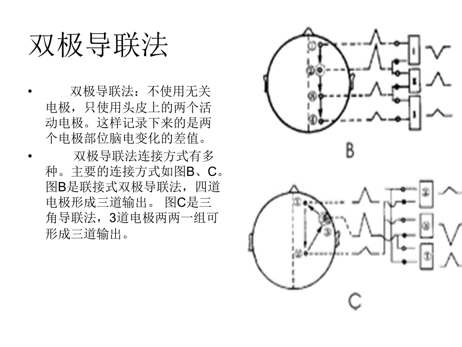 脑电图机的导联方式_第4页