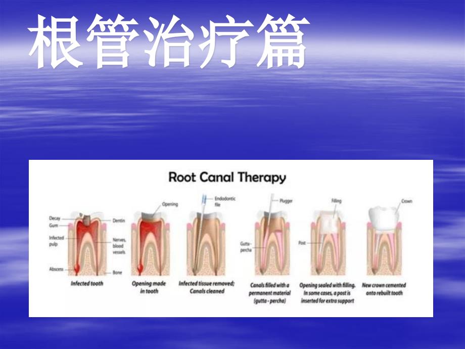 口腔器械认知_第2页