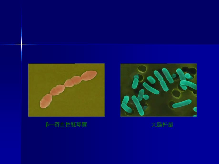 妇产科学教学课件：产褥感染_第4页