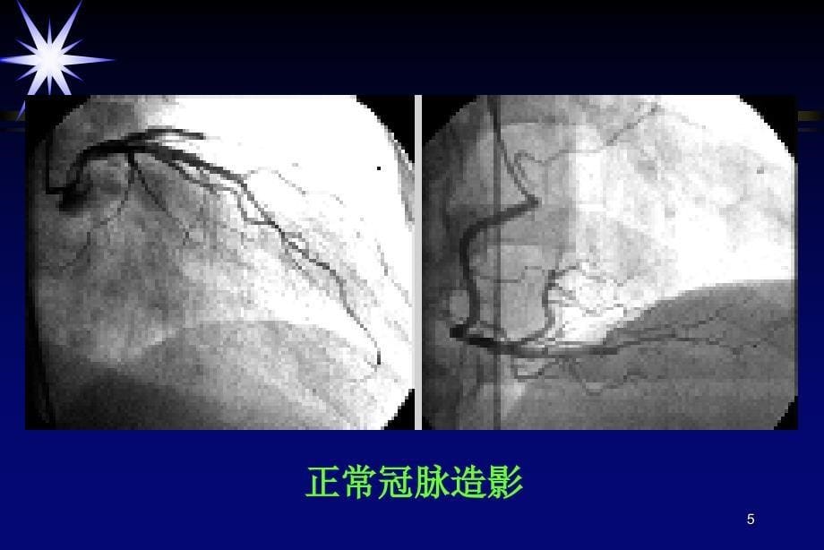 循环系统ppt课件_第5页