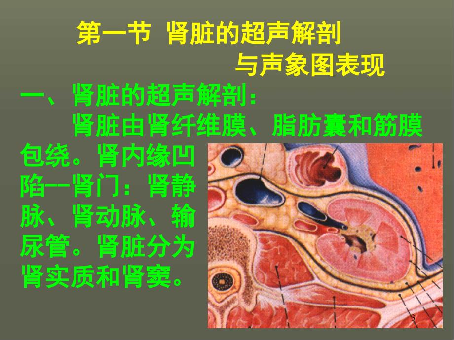 泌尿系统的超声诊断PPT幻灯片.ppt_第3页