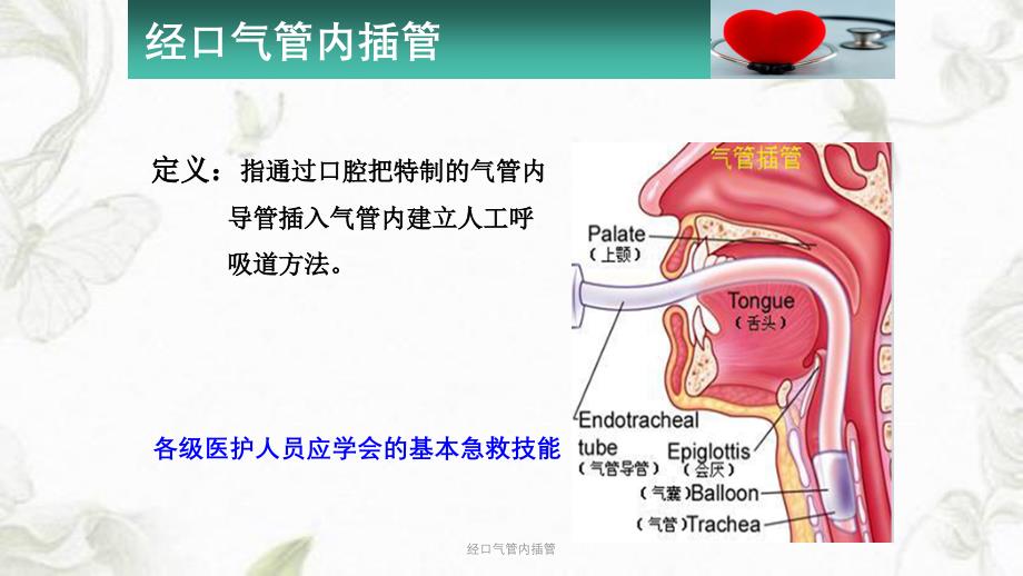 经口气管内插管ppt课件_第2页