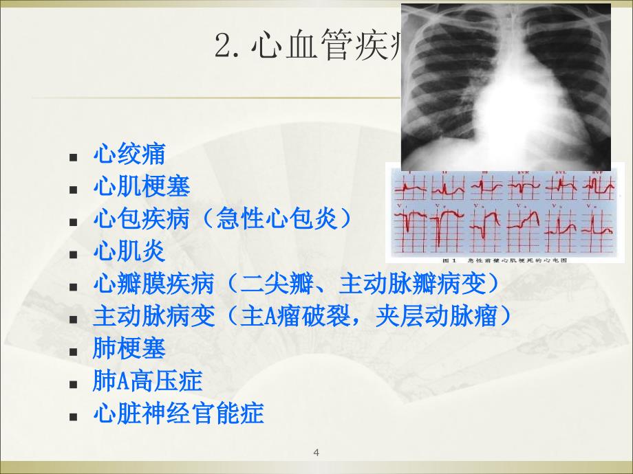 胸痛本科诊断学ppt课件_第4页