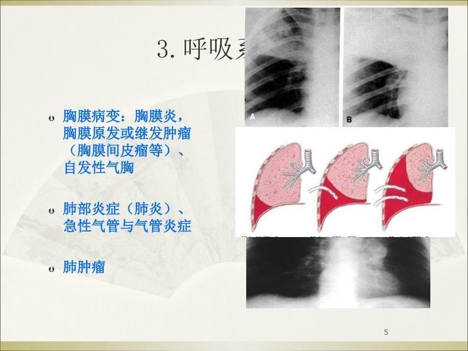 胸痛本科诊断学ppt课件_第5页