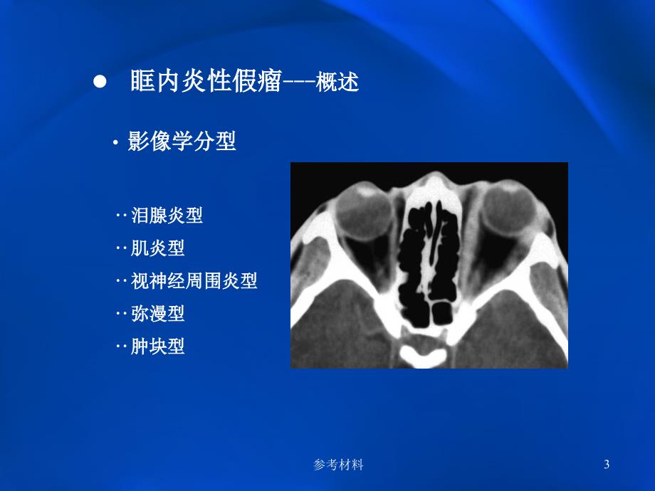 眶内炎性假瘤影像学内容详析_第3页