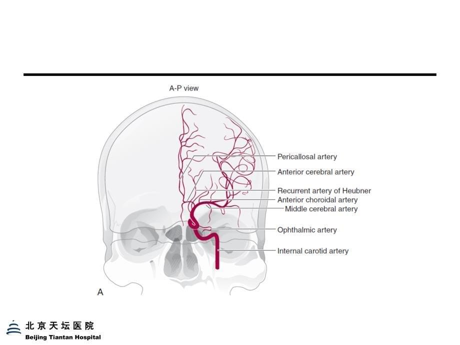 脑血管定位诊断 ppt课件_第5页