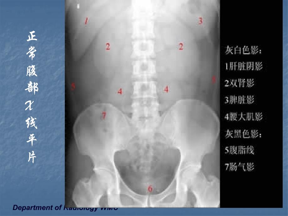 医学影像学：消化系统1_第3页