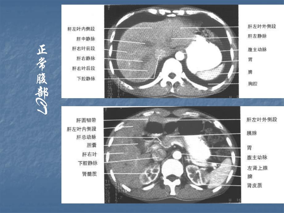 医学影像学：消化系统1_第4页