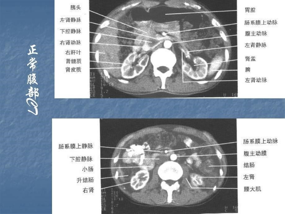 医学影像学：消化系统1_第5页