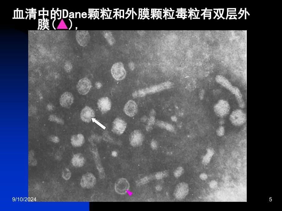 《乙肝五项临床意义》PPT课件_第5页