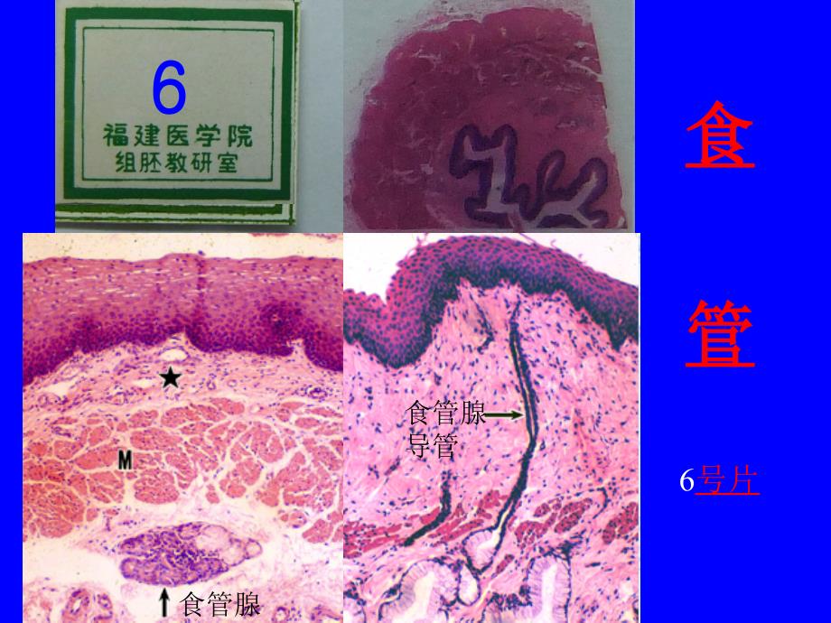 组织学与胚胎学实验课课件：9 消化管_第3页