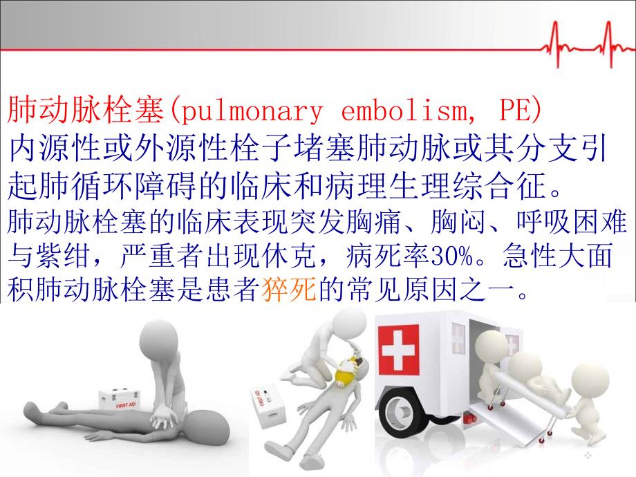 优质医学下腔静脉滤器的选择介绍_第3页