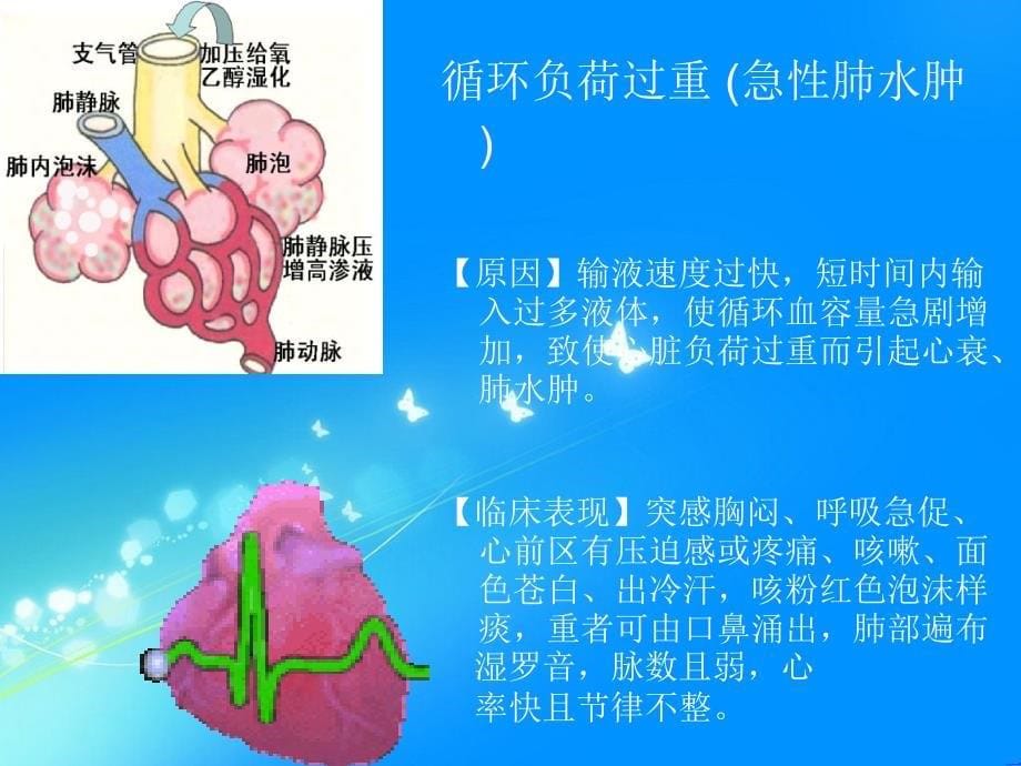 静脉输液反应ppt课件_第5页