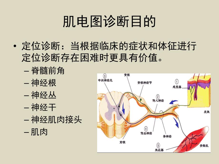 肌电图科内讲座_第4页