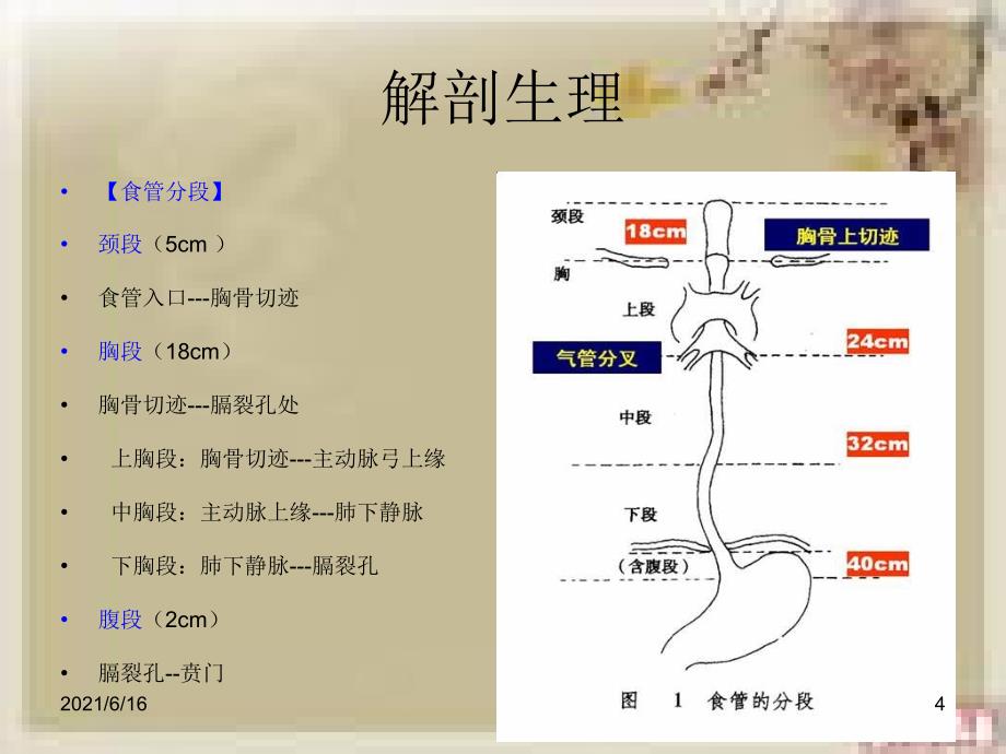 食管癌的教学查房_第4页