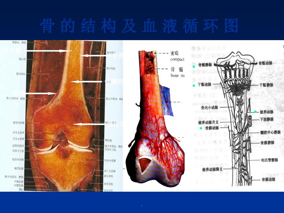 骨关节基本病变X线表现_第4页