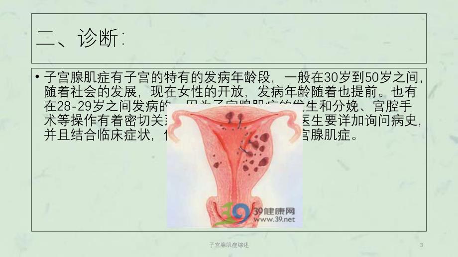 子宫腺肌症综述课件_第3页