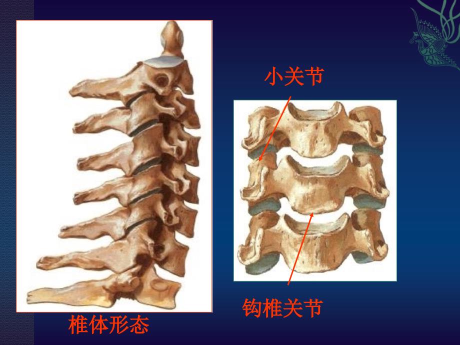 中医治疗颈椎病.ppt_第4页