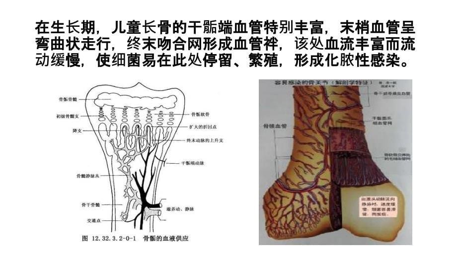 骨与关节感染病人的护理课件_第5页