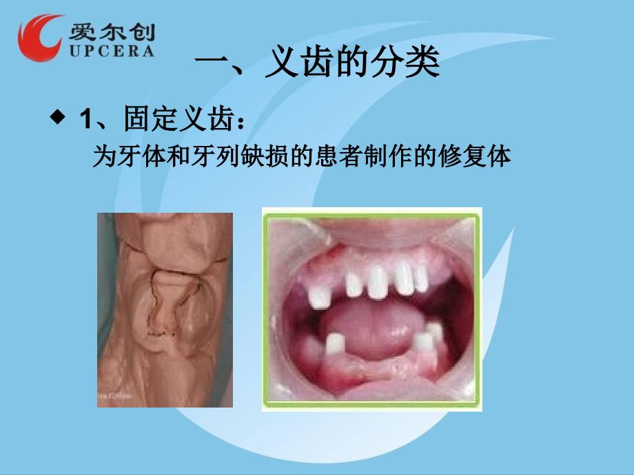 爱尔创义齿的基本知识_第3页