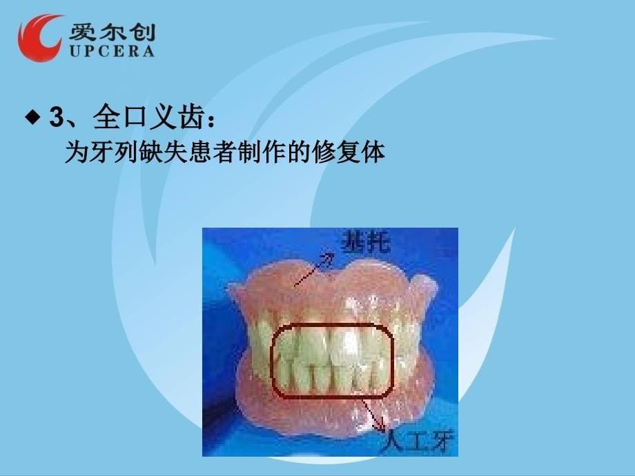 爱尔创义齿的基本知识_第5页