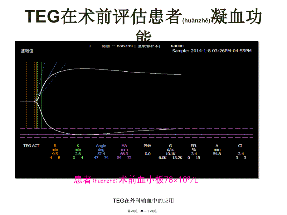 TEG在外科输血中的应用课件_第4页