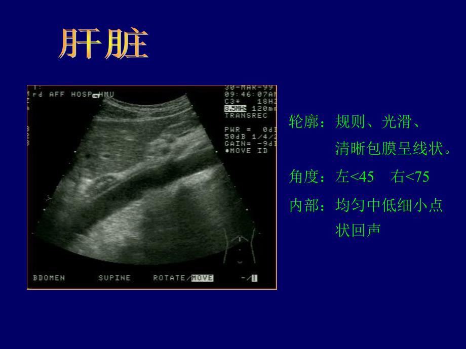 B超影像图谱_第1页