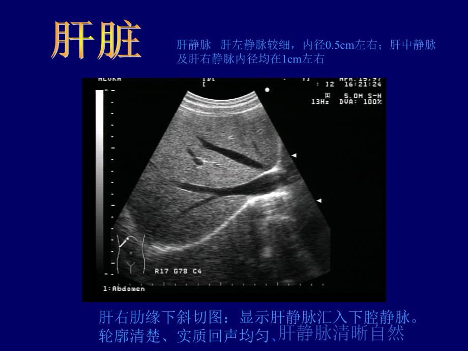 B超影像图谱_第2页