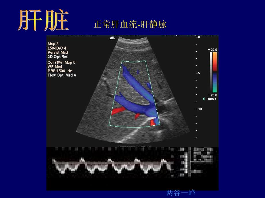 B超影像图谱_第3页