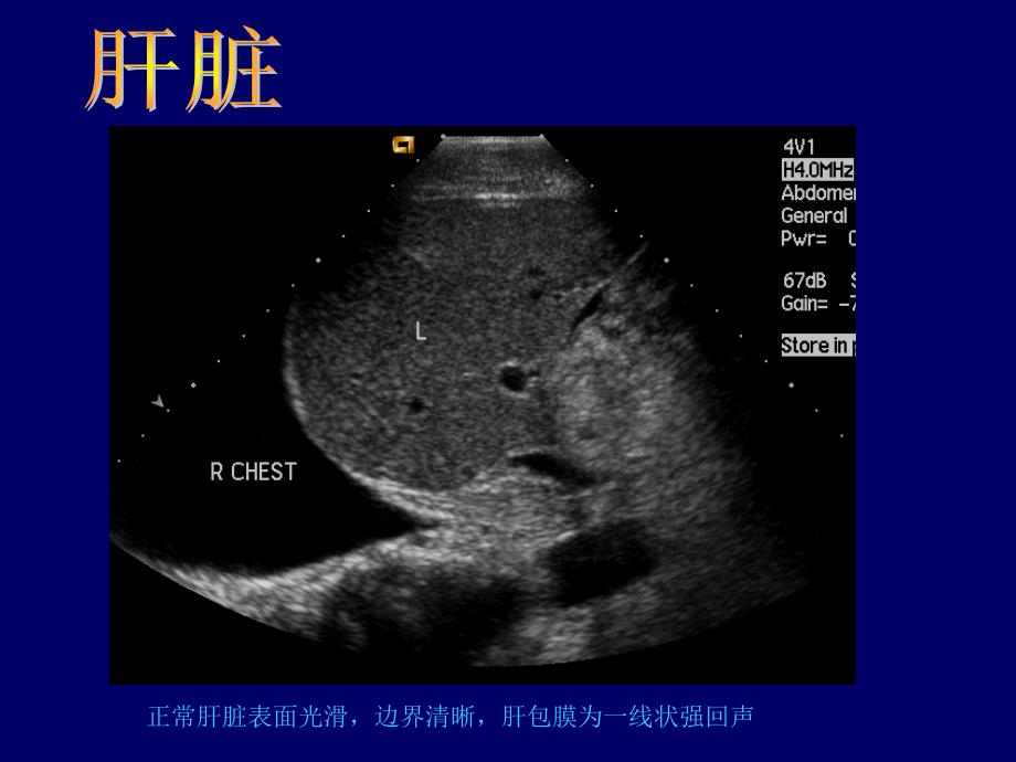 B超影像图谱_第4页